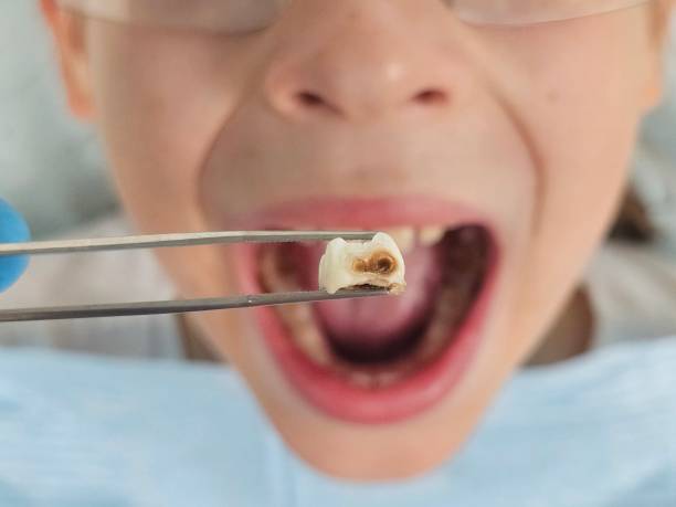 Best Teeth Whitening  in Toledo, OR
